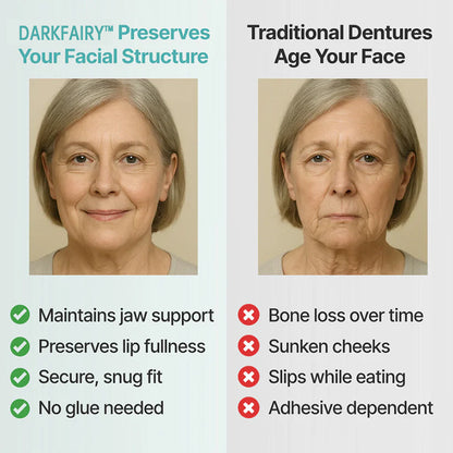 ✨ Ends Today: 70% OFF! DarkFairy™? Custom-Fit Full Functional DenturesMake you more confident